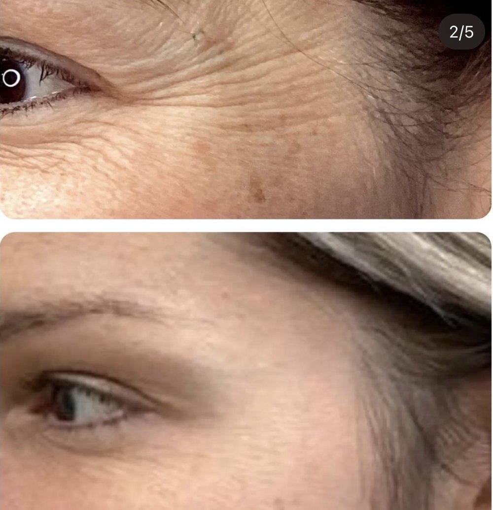 Before and After photos