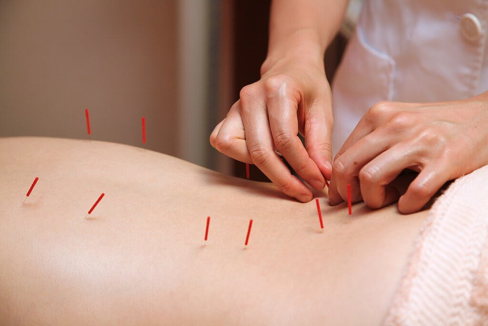 Acupuncture at Premier Integrated Health & Wellness, PC